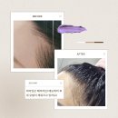 [06/19] 사진촬영 중급 과정(제품사진기법) | [뷰티어리] 에보케어 생장술 효과, 속눈썹 두피관리 탈모 개선 전후 비교