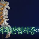 명의 헬스케어 - 척추관협착증이란? 이미지