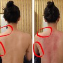 디어마이바디 | 안양바디관리 | 안양 디어마이스파 등관리 솔직 후기 ( 고주파+골드툴 괄사) - 진짜 시원해요, 안양...