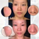 라비에 에스테틱 | 지흡바본관리와 피부관리, 두피케어 관리까지 [안산 중앙동 라비에에스테틱]