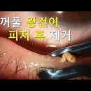 눈꺼풀 왕건이 짜기 시리즈 이미지