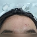 기능성머쉬 | 여드름 피부 화장품 추천, 접촉성 피부염 크림, 여드름 수분 크림 마스크팩 스킨케어 모음, 내돈내산 후기