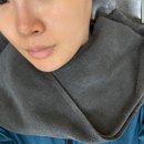 심한의원 | 일산의원 이중턱 고민 온다리프팅 후기