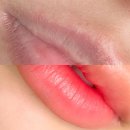 아인뷰티의원 이미지