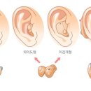 제주그랜드보청기 이미지
