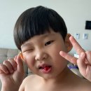 안치과 | 새 이가 올라오는데 유치가 안 흔들려요! 치과에 다녀온 후기