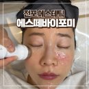 바이포미