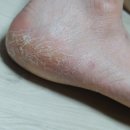 깍고밀고이발 이미지