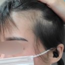 모블링스 부산지사 | 부산탈모 / 빈모커버 / 커버의신 모블링스 소개합니다