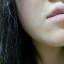 샤넬멍 | 샤넬주사 통증 멍 부작용 후기 미백 모공 시술 추천