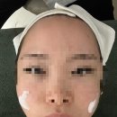 양덕동203 | [마산] 마산 양덕동 에스테틱매일크리스마스 수분관리 | 데콜테관리잘하는 피부샵