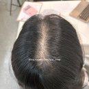 니아뷰티 | 마곡 두피문신 3개월 후 리터치 후기｜가르마두피문신 니아 두피문신
