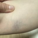 성주핏