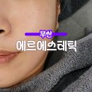 부산 양정 피부관리 슈퍼젝션 연산동 근처 전문 에르에스테틱 후기