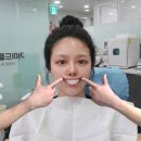 잇플란트치과의원 네이버블로그