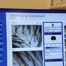 용산-309 | 서울 용산 여성 탈모 케어 센터 모나클 두피탈모센터 산후 탈모 찐 후기