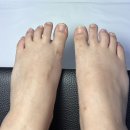 대구아크릴 | 대구 아크릴연장 람페로마에서 몬난이 발톱 탈출! 대구 아크릴패디 후기