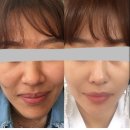로덱스 화장품 네이버블로그