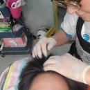 권동하 | [두피/탈모관리] 구로 탈모관리 전문 "네오두피"에서 두피 MTS, SMP 상담 받고 왔어요