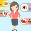 고혈압의 합병증 이미지