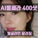 이미지캔 | 울쎄라 400샷 효과 있나요? AI메타스캔 맞춤 리프팅 후기