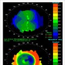 권안경콘택트 이미지