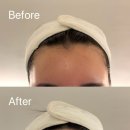 하로하로 | 부산 동해 헤어라인 왁싱 "하로왁싱" 방문후기