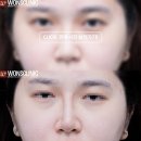 하이코코 이미지