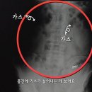 중앙항외과 네이버블로그