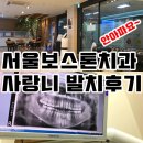 금강치과기공소 | 의정부 서울보스톤치과에서 사랑니 발치 했어요