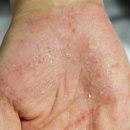 자주고름 이미지