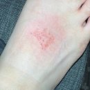 꽃무리 뜸 | 구마모토 여행기