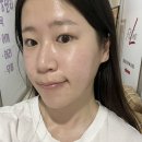 새아뷰티 | 김해내외동피부관리 새아뷰티 후기 피부 속건조 해결