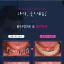 서울더좋은치과 이미지