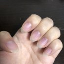네일아이밍