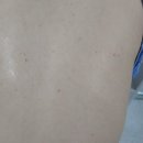 카밍독 | 등드름 바디미스트 가드름 바디미스트 테카테카 카밍 바디미스트로 빠르게 진정