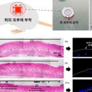 솔솔케어