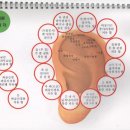 이혈요법 이미지