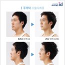 뼈연구소 OSEN