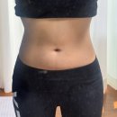 러브라인 | 신사다이어트주사 받고 복부+러브핸들 라인 달라진 5주 찐 후기