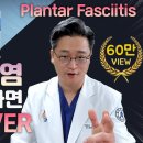 ★★★ 족저근막염이 잘 낫지 않는 이유(치료방법 동영상 보세요~)★★★ 이미지