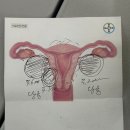 유민헬스케어 | 천안자궁근종수술 잘하는 곳｜복강경 단일공 퀸스산부인과 후기