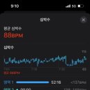 소프트 오프닝
