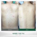 세리영 스킨케어 네이버블로그