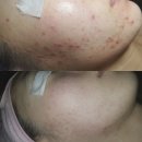 아리따운피부 이미지