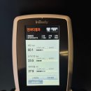 서초남서울 | 누워서 살빼는 바디움서초본점 프리미엄다이어트 1회 변화 후기