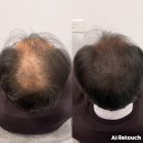 두피 고민은 :: 일산두피 일산 두피&눈썹 단미토탈뷰티 일산본점