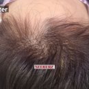 시커스뷰티센터 이미지
