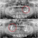 오*재 이미지