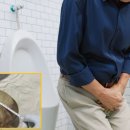 “이게 몸속에 있었다고?”… 방광서 3.1kg 거대 결석 제거, 세계 최대 기록? 이미지